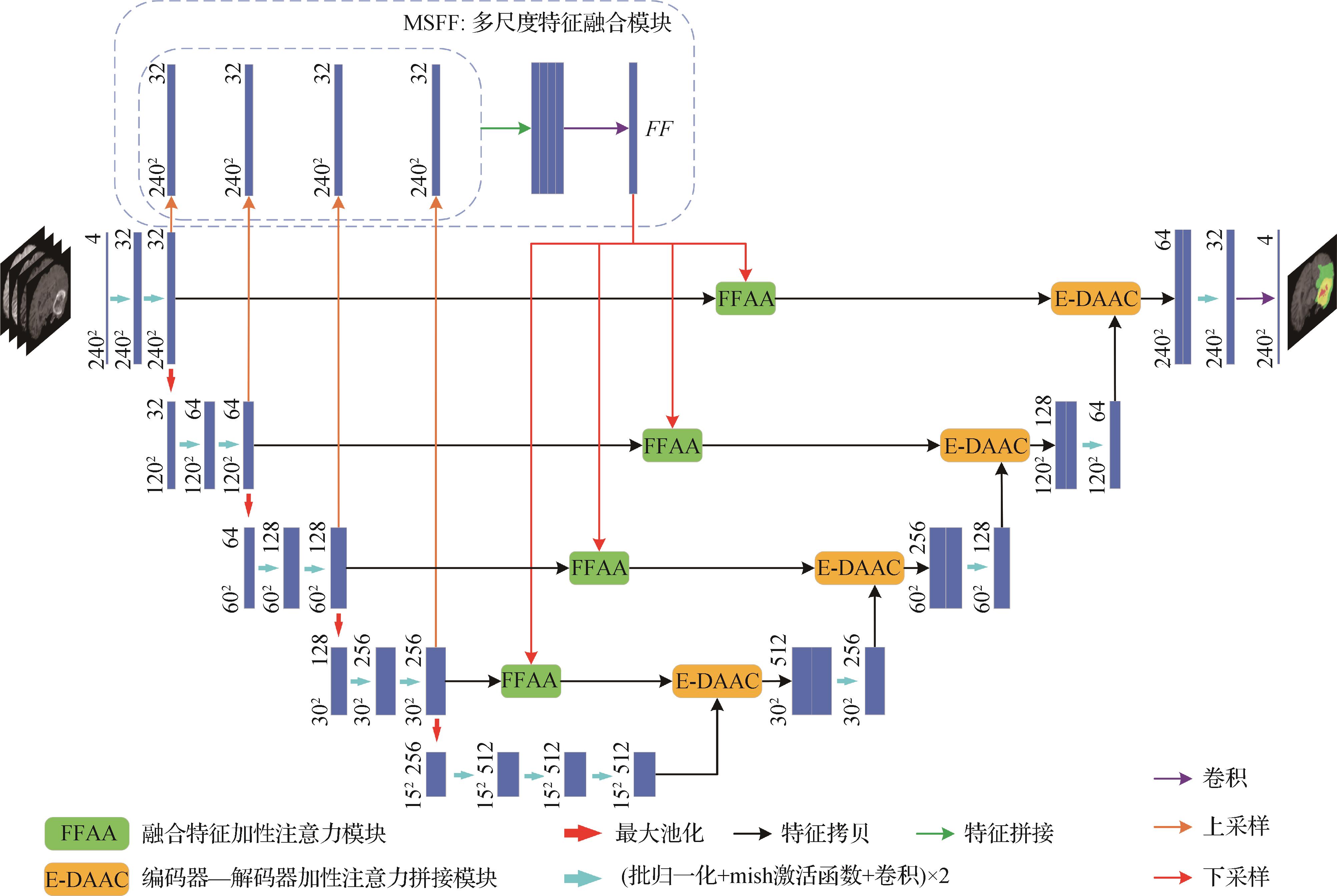 多尺度特征融合与加性注意力指导脑肿瘤MR图像分割