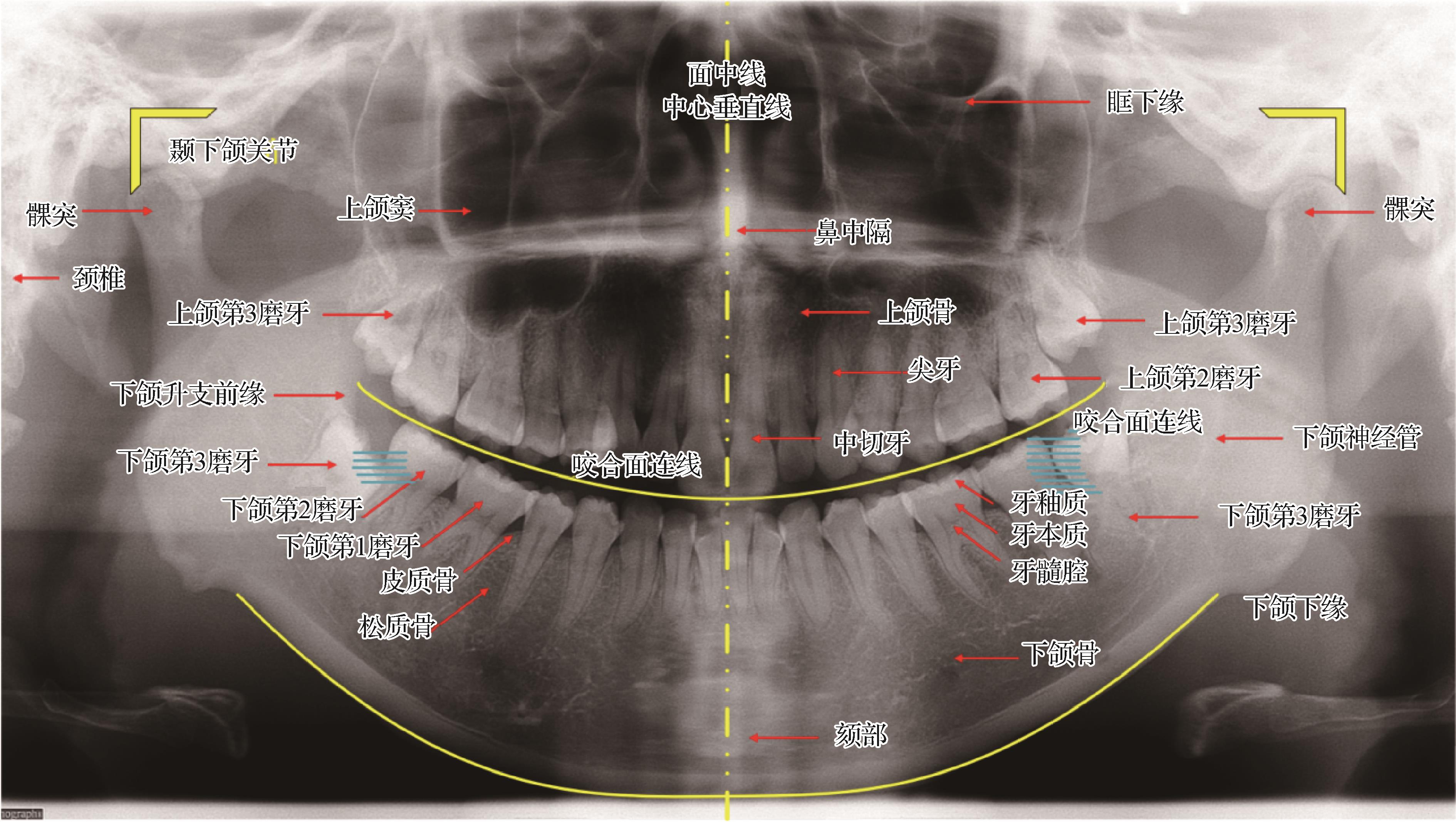 面向全景智齿检测的内卷解耦轻量化网络